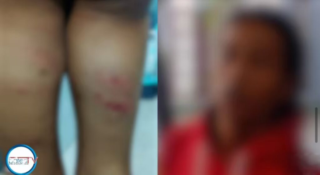 Kynnoh u samla ba shah pynshitom ha Sohra PS, hap dih da ka um painkhana, ujor sha ka MHRC