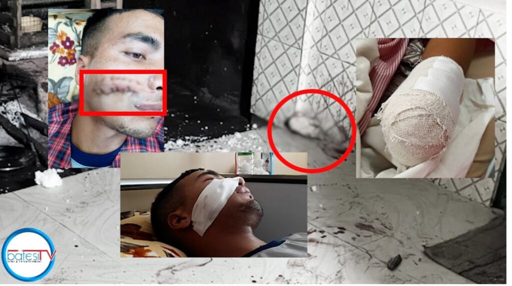 Dkut ka kti kadiang ka tnga ba shah mait da ka wait ha u tnga, mudui ejahar ki khun ïa u kpa