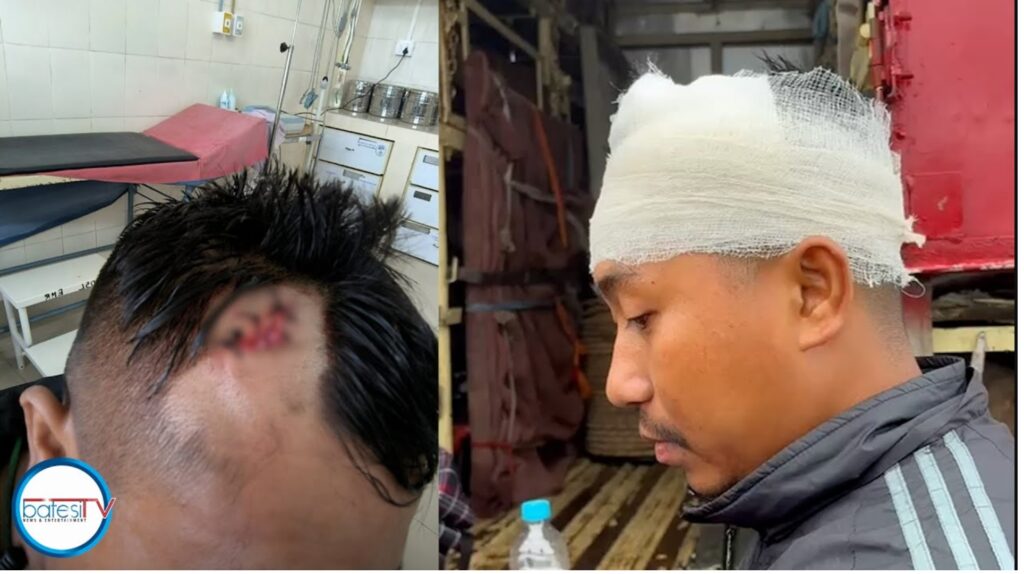 Hap u maw na khlieh u SRT ha riat Rngaiñ, donbok ba phong helmet