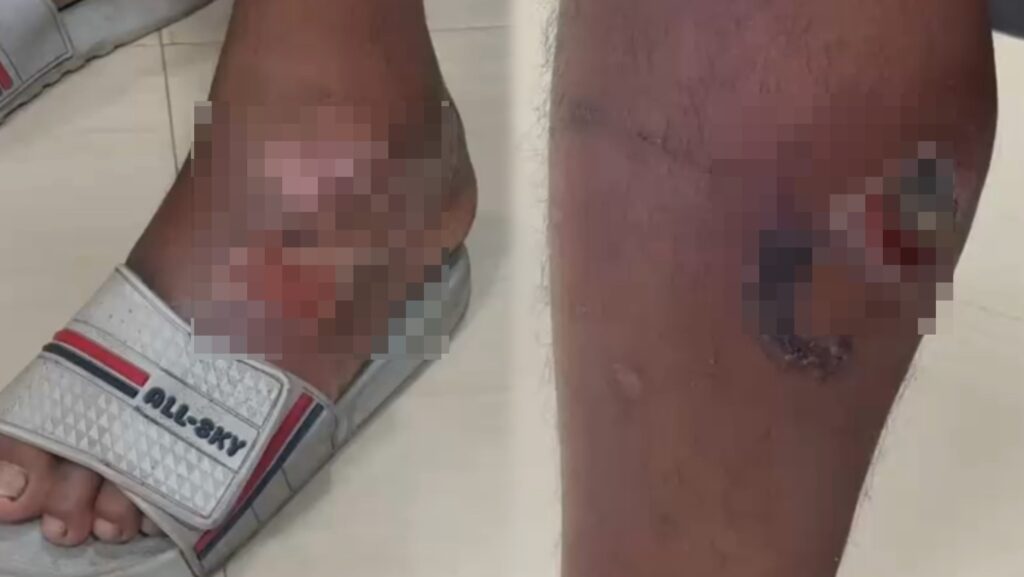 “Peit me tang shu mut weng ïa ka FIR u Pulit un wan ha ïing jong me ban kem,” phla u nongñiah trok