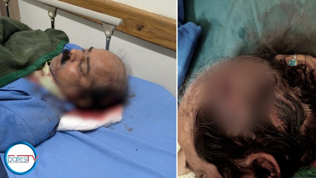 Mynsaw u Registrar ka skulbah NEHU ba shah kawang maw ha ki runar ha surok Mawlai Bypass