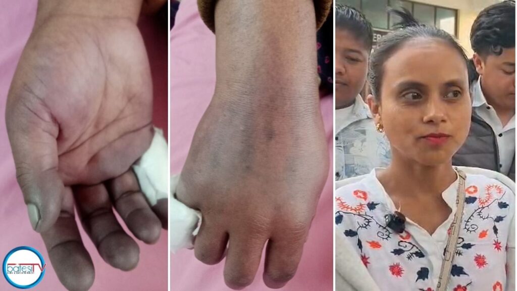 PATIENT’S HAND SWELLS AFTER ALLEGED WRONG INJECTION BY NURSE AT NEIGRIHMS