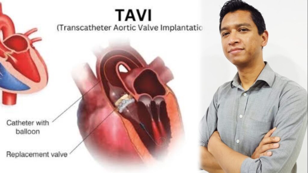 Meghalaya achieves healthcare milestone with state’s first TAVI procedure using indigenous MYVAL heart valve