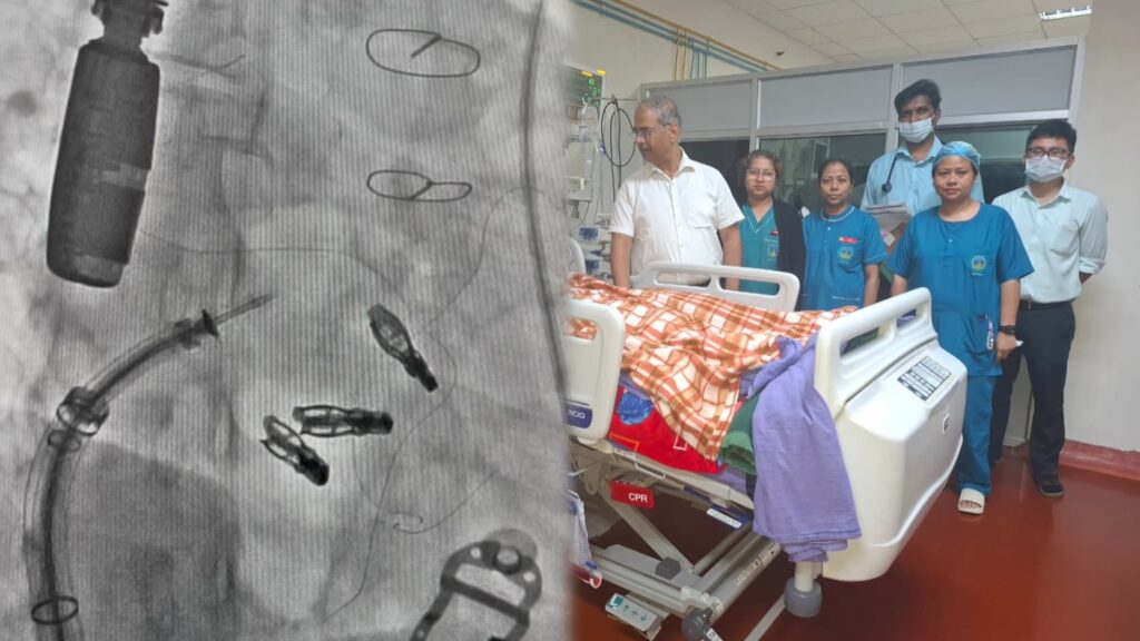 NEIGRIHMS Performs Landmark Minimally Invasive Heart Procedure, Saves 27-Year-Old Patient