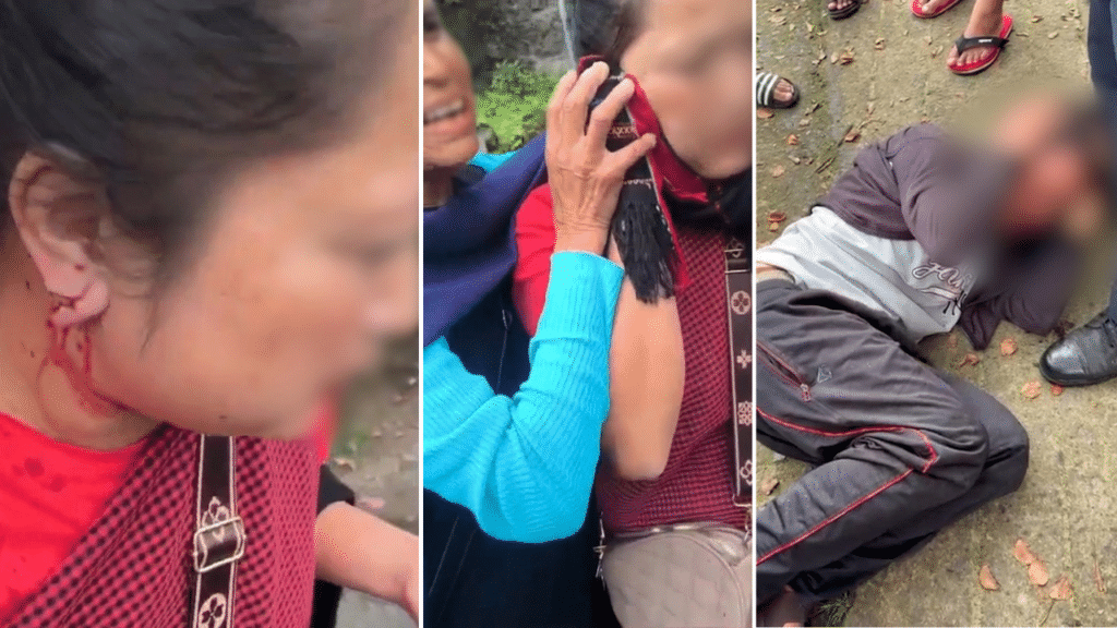 Woman injured after gold earrings snatched near Civil Hospital in Shillong