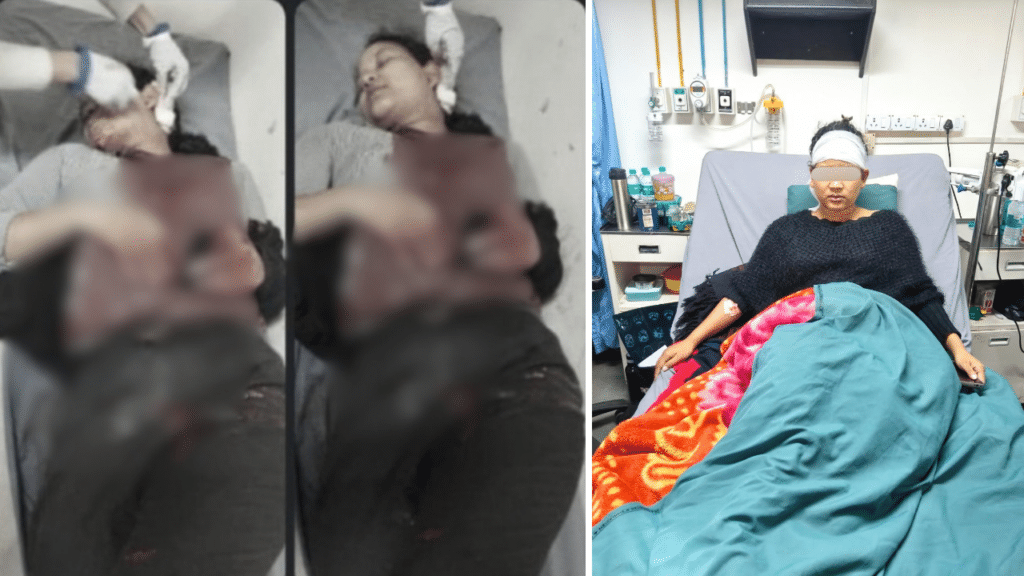 Woman Stabbed in Neck, Robbed of Mobile Phone at Nongmensong; Suspect Arrested